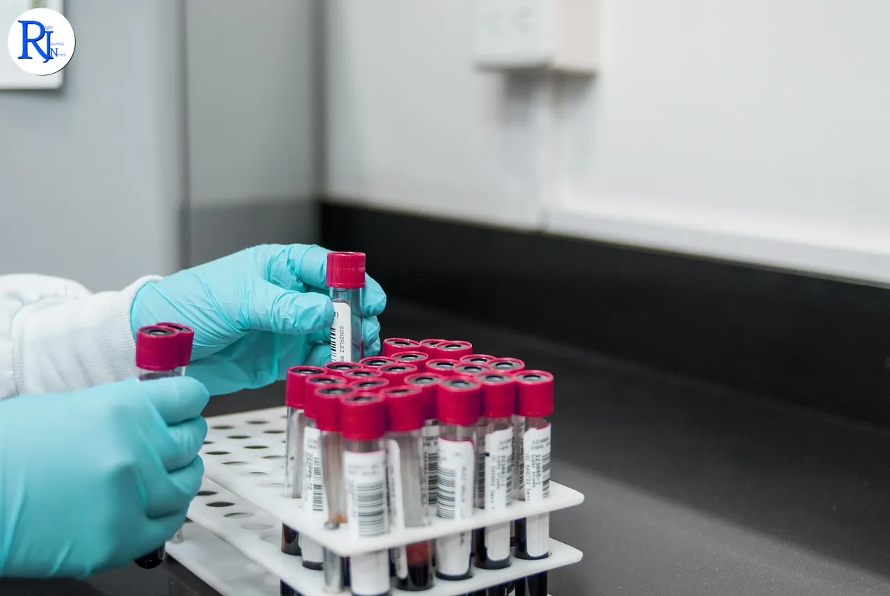 Breakthrough Blood Test Promises Enhanced Alzheimer's Diagnosis Accuracy
